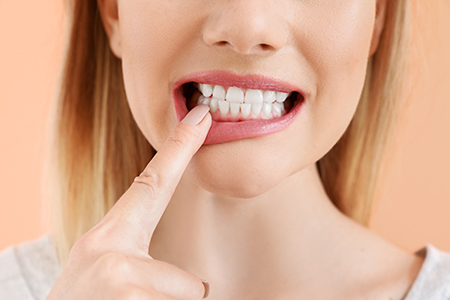Deaton Dental Associates | Dental Bridges, Extractions and Periodontal Treatment