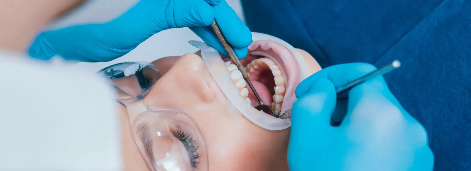 Dental Fillings at Summerville dentist