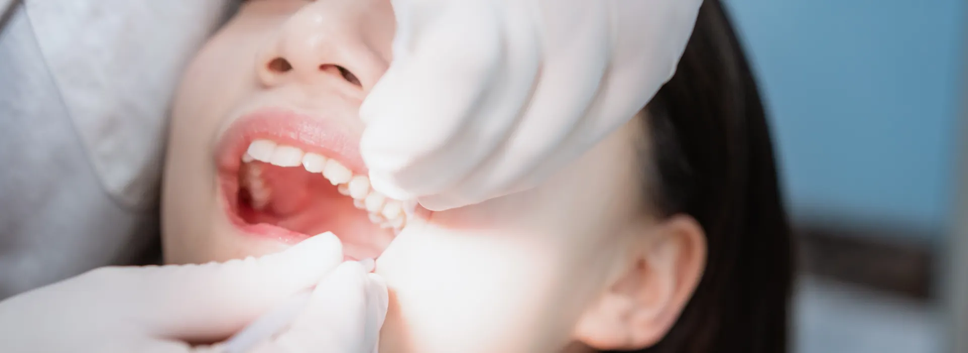 Dental Tooth extractions in summerville