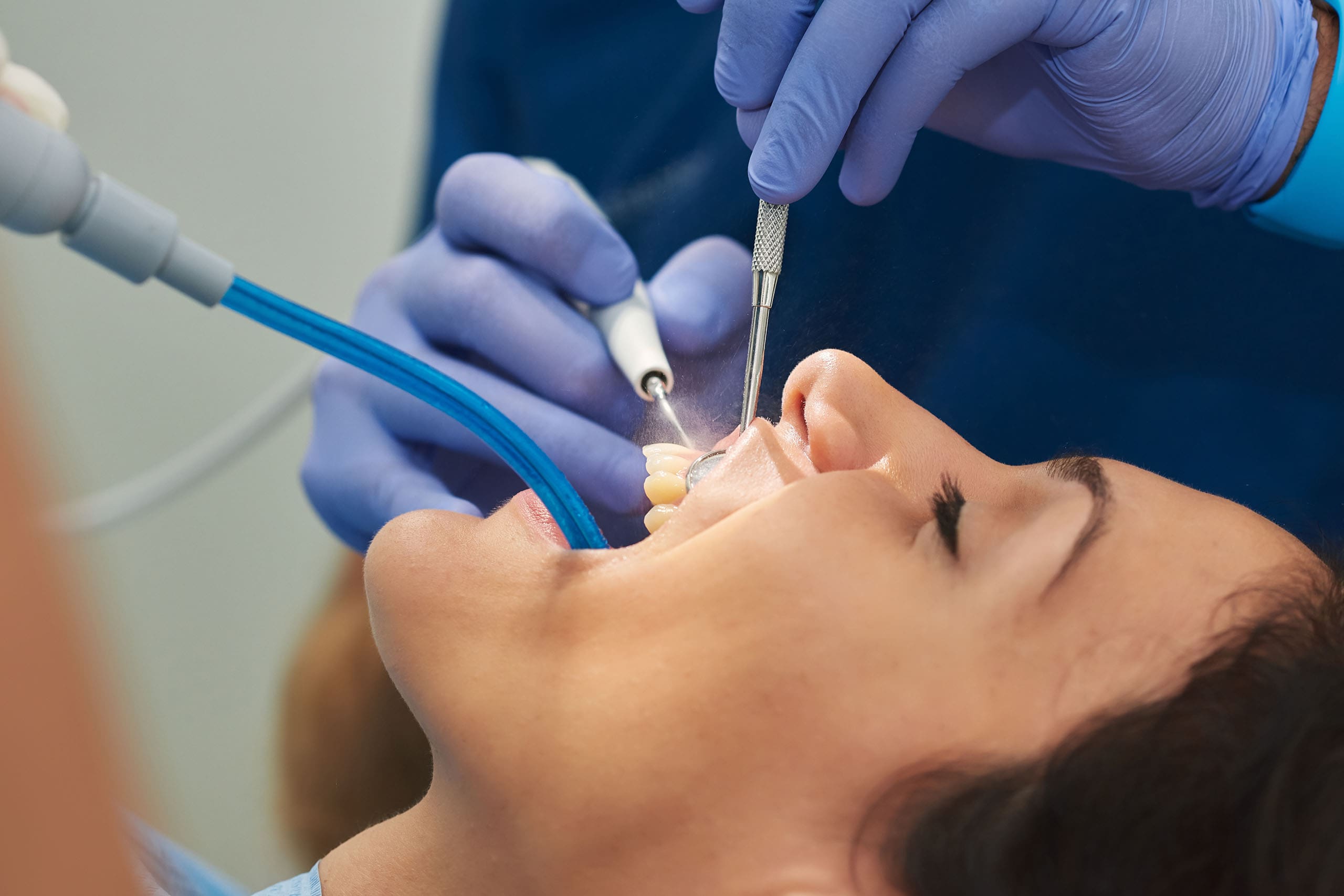 How Long Does a Dental Cleaning Take?